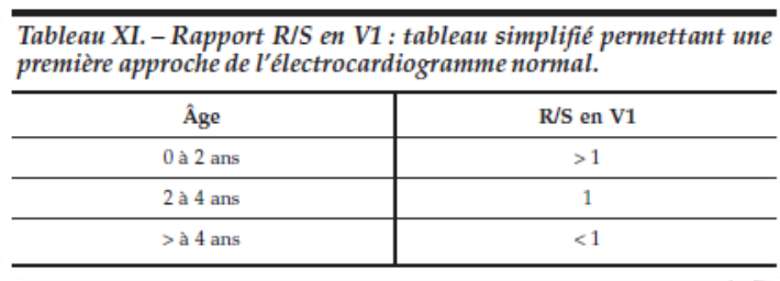 Fichier:Image 2.2.png