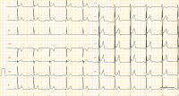 Cas clinique miniature