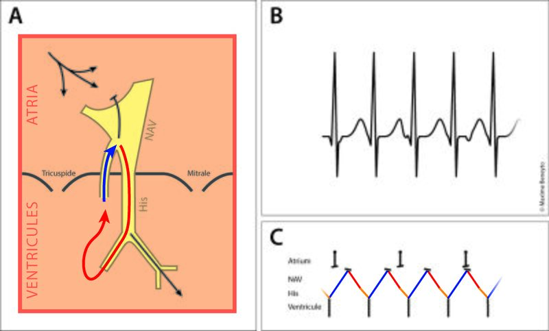 Fichier:Figure 6 - IART.jpg