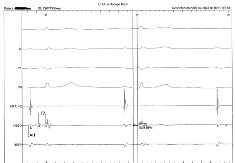 Fichier:EEP Baie d'électrophysiologie.png