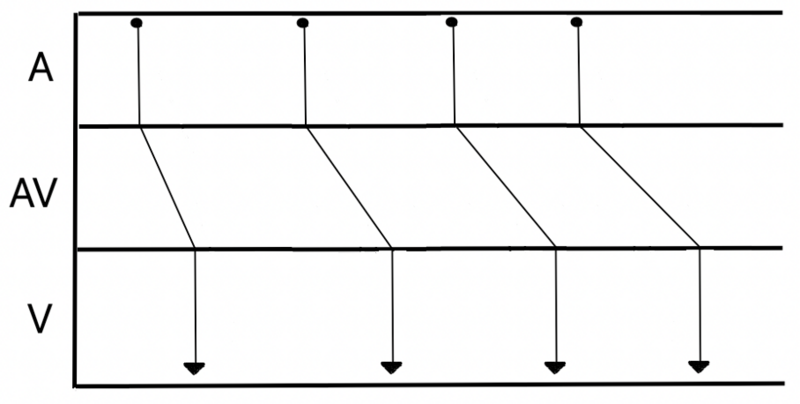 Fichier:Dromodecrement.png