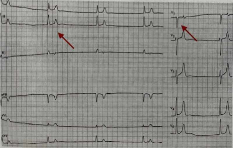 Fichier:ECG .png