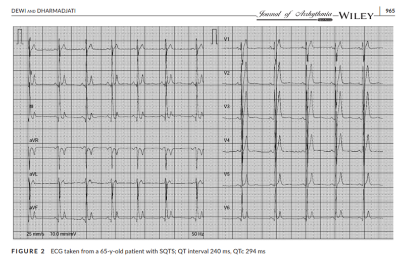 Fichier:Morphologie SQTS.png