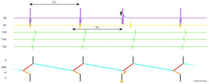 Fichier:Figure 20 - HRPVC.jpg