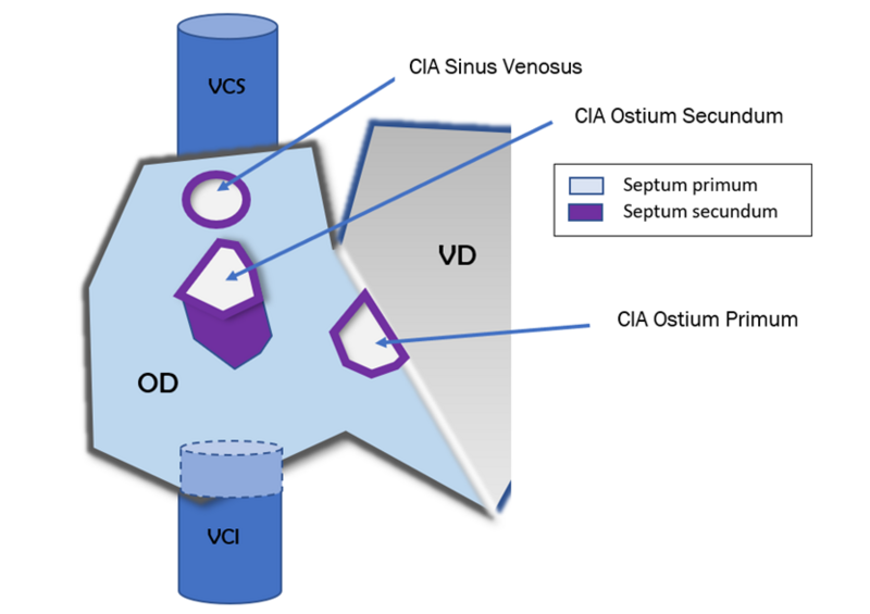 Fichier:Anatomie des CIA.png