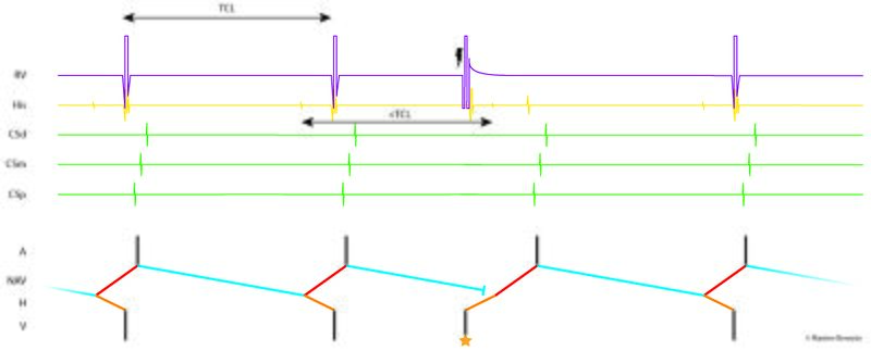Fichier:Figure 19 - PVC.jpg