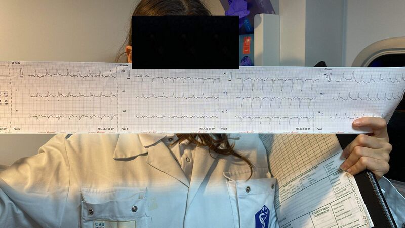 Fichier:ECG 3.jpg