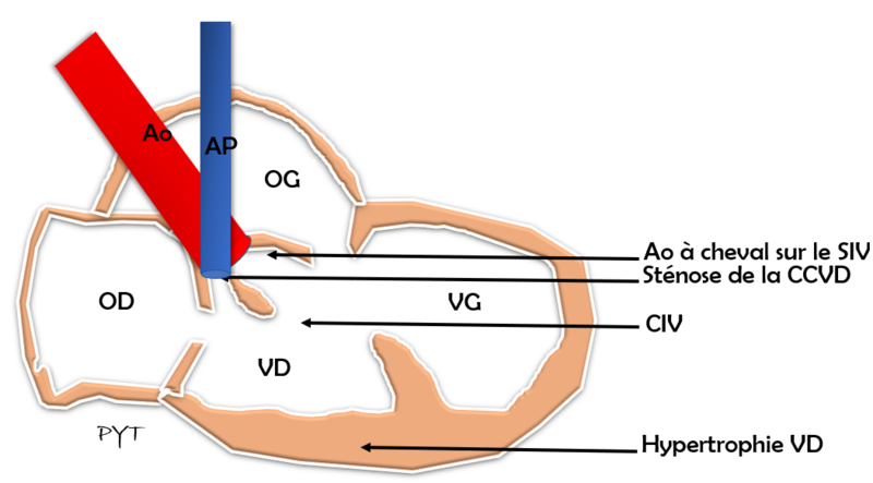 Fichier:Anatomie TOF.png