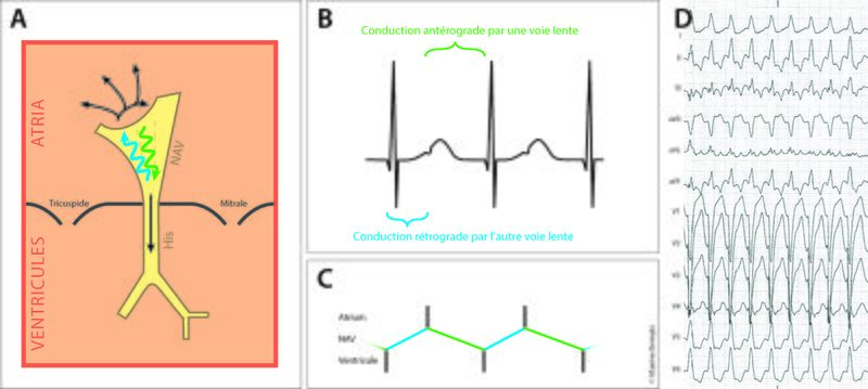 Fichier:Figure 5 - Slow-slow.jpg