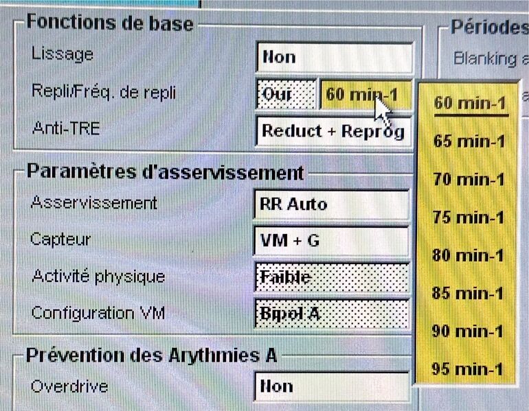 Fichier:CAM Sorin.jpg