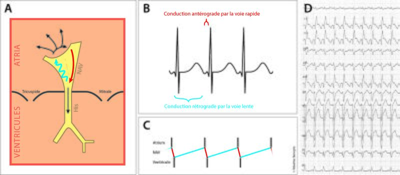 Fichier:Figure 4 - Fast-slow.jpg