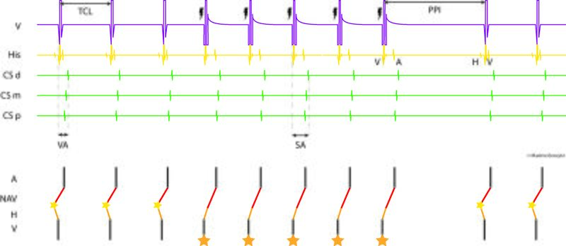 Fichier:Figure 3 - VOP.jpg