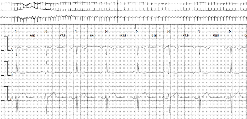 Fichier:Holter wiki.png