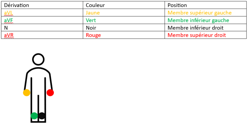 Fichier:Positions des électrodes.png