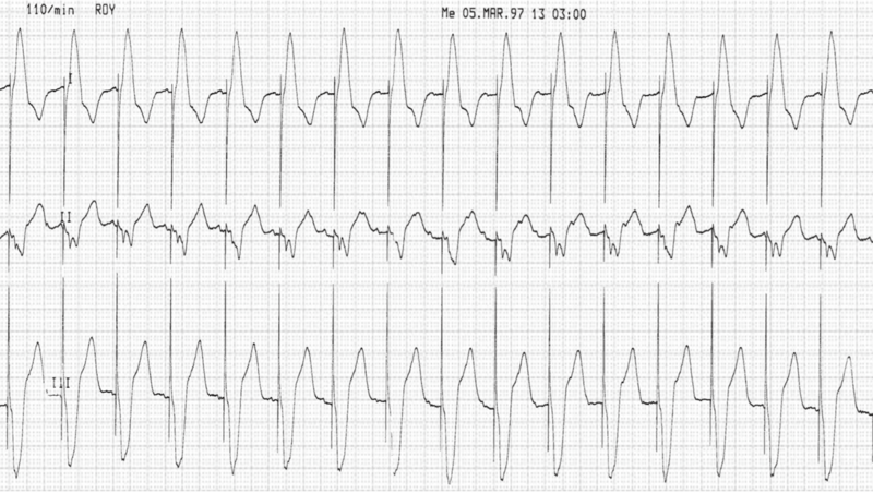 Fichier:Flutter EE.png
