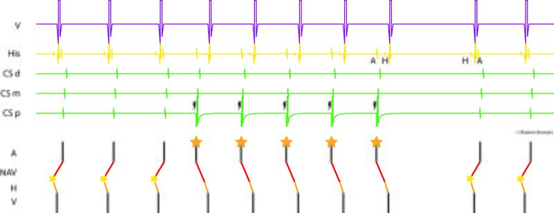 Fichier:Figure 5 - AOP.jpg