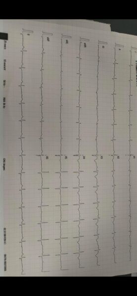 Fichier:ECG 1 .jpg