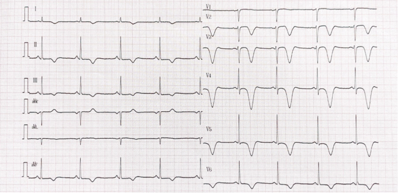 Fichier:Figure 4.png