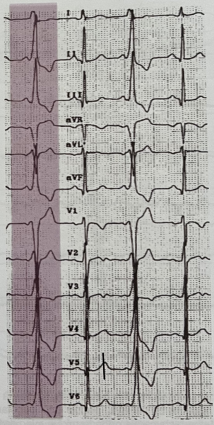 Fichier:ECG.png