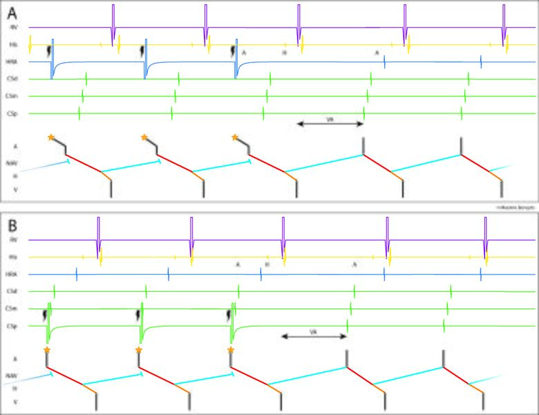 Fichier:Figure 18 - Maruyama.jpg