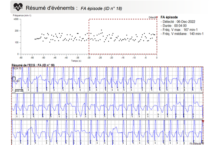 Fichier:FA télécardiologie.png