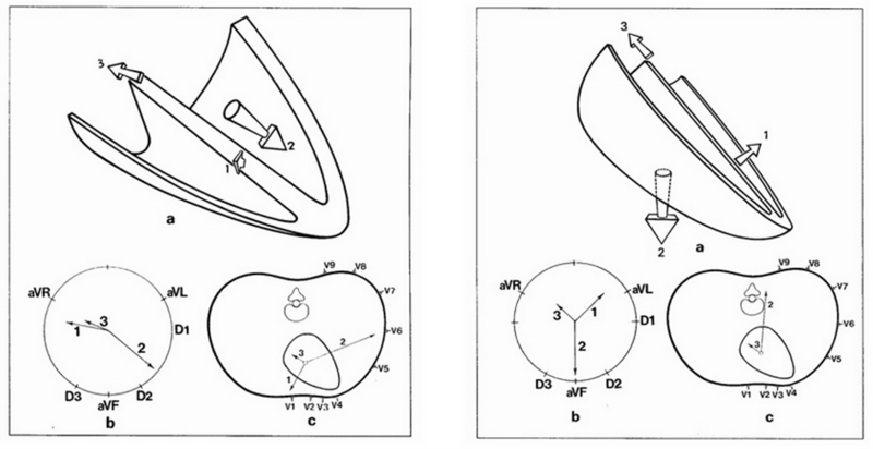 Fichier:Dextrorotation.png