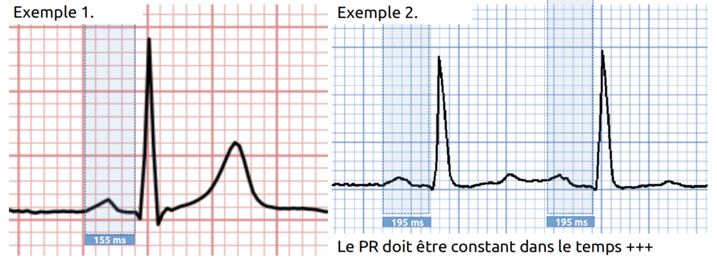 Fichier:PR.png