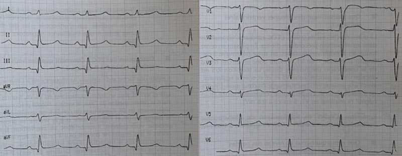 Fichier:S1Q3.png