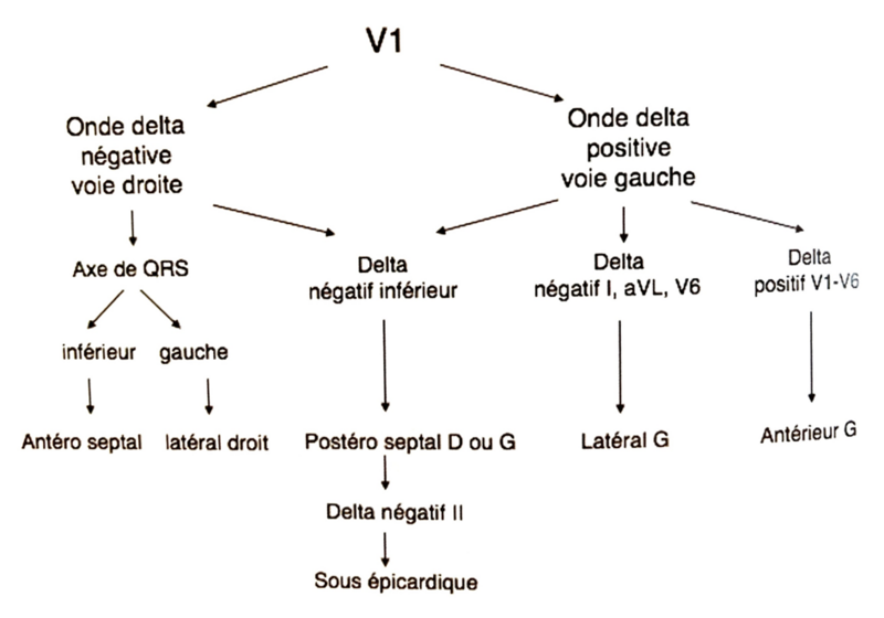 Fichier:Algorithme .png