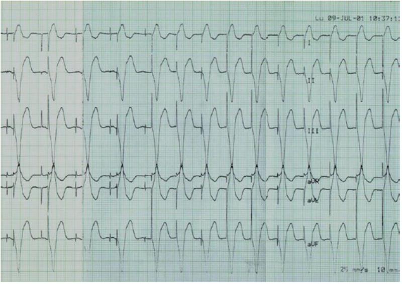 Fichier:WIKI ECG.png