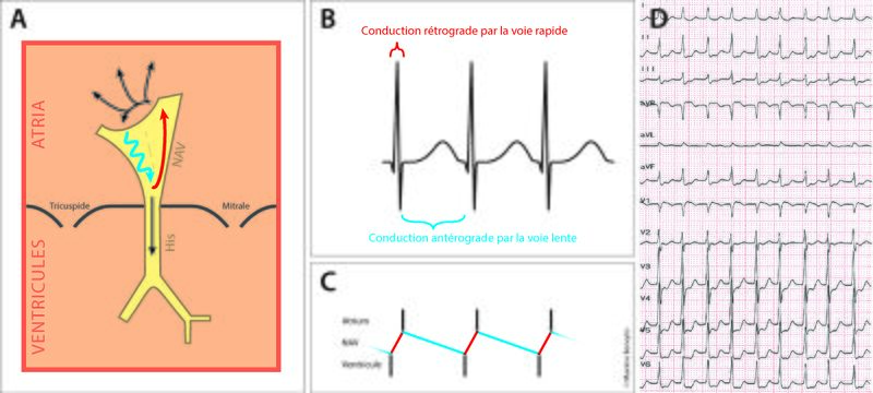 Fichier:Figure 3 - Slow-fast.jpg