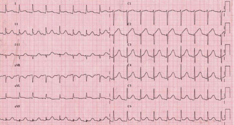 Fichier:Figure 3.png