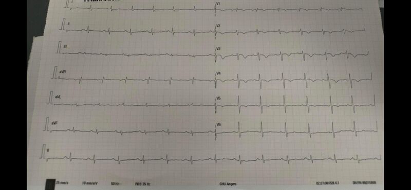 Fichier:ECG 1.jpg