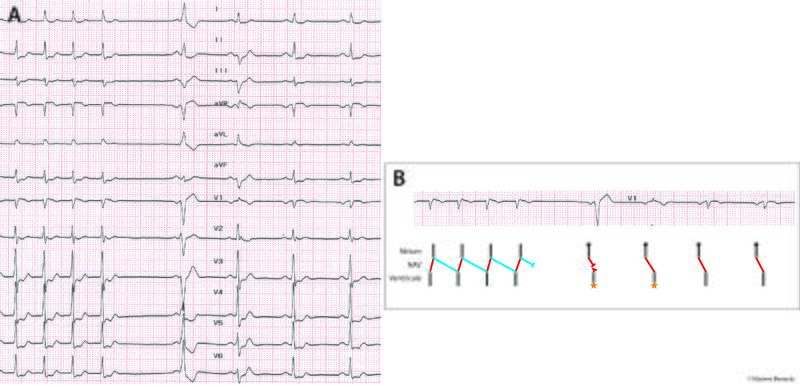 Fichier:Figure 7 - Réduction.jpg