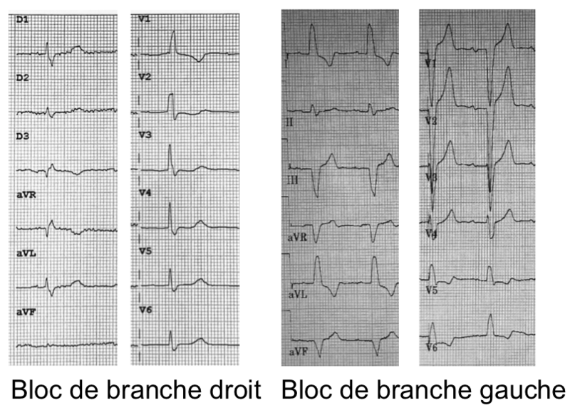 Fichier:Bloc branche.png