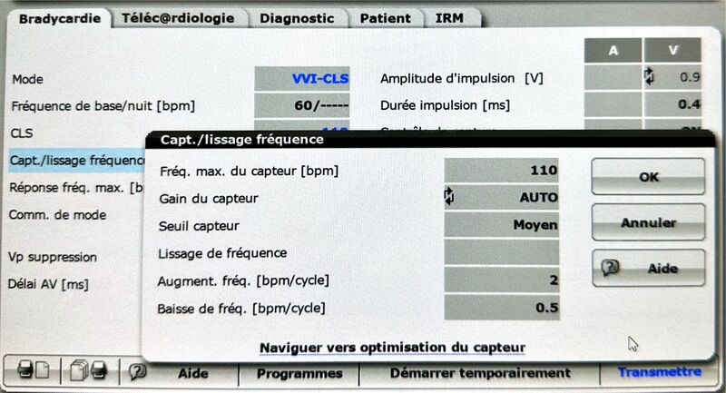 Fichier:Asservissement Biotronik.jpg