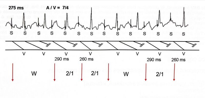 Fichier:Figure 4 -.jpg