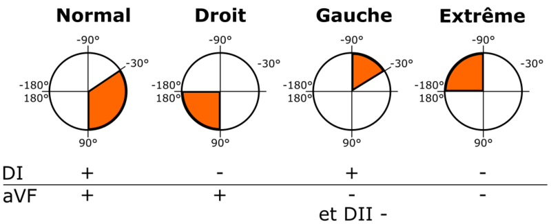 Fichier:Axe du coeur.png